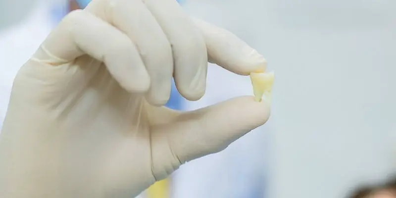 Những điềm báo từ việc mơ thấy nhổ răng